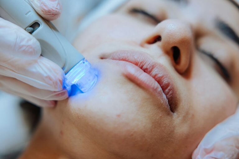 A Smart Guide to Preparing for Advanced Laser Skin Treatments